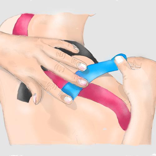 Kinesiotape